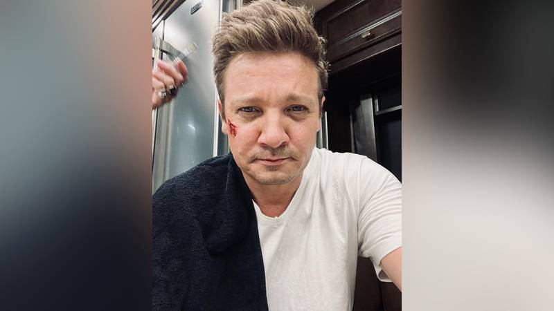 Actor Jeremy Renner sufre grave accidente que lo mantiene en estado crítico